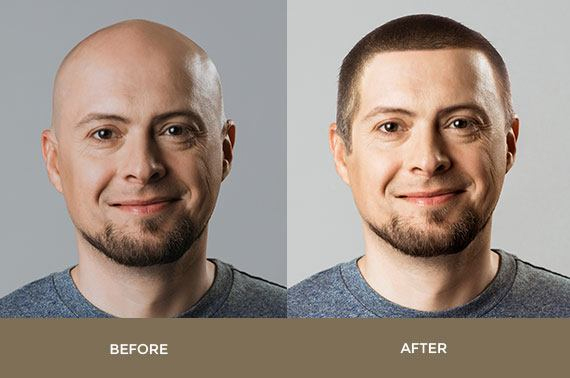 before-after-1