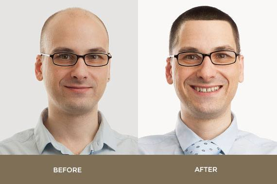before-after-2